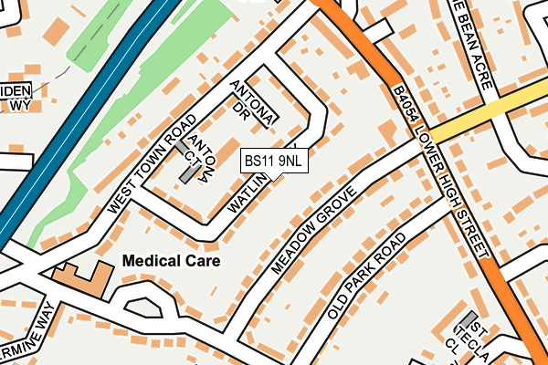 BS11 9NL map - OS OpenMap – Local (Ordnance Survey) BS11 9NL map - OS OpenMap – Local (Ordnance Survey)