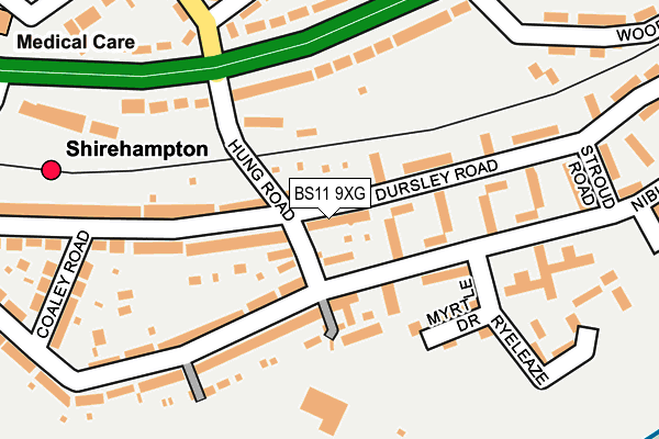 BS11 9XG map - OS OpenMap – Local (Ordnance Survey)