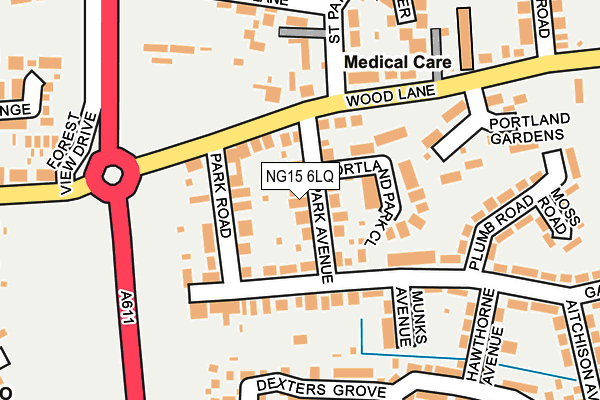 NG15 6LQ map - OS OpenMap – Local (Ordnance Survey) NG15 6LQ map - OS OpenMap – Local (Ordnance Survey)